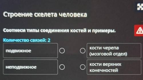 Строение скелета человека Соотнеси типы соединения костей и примеры.Количество связей: 2подвижноекос
